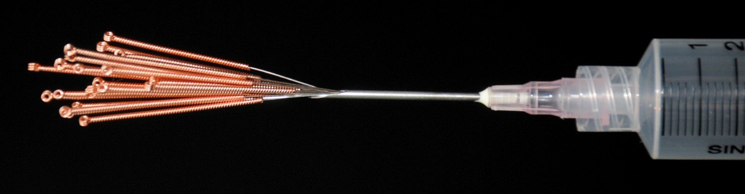 Dry Needling - TheSpineWorx.com
